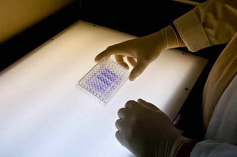 Axovant, AXON,  Auspex Pharmaceuticals, Inc. (ASPX)