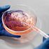 5 Best Gene Therapy Stocks to Buy in 2026