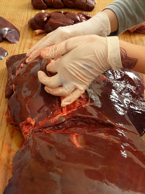  High Cholesterol Foods Not to Eat