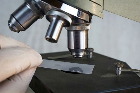 Zentalis (ZNTL) Locks In Its Cancer Drug Dose; Jefferies Raises the Target