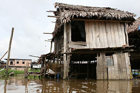  Most Underdeveloped Countries in the World in 2018