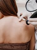 20 Countries with the Highest Rates of Skin Cancer