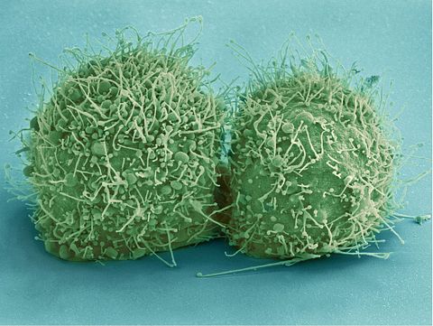 hela-cells-544318_1280