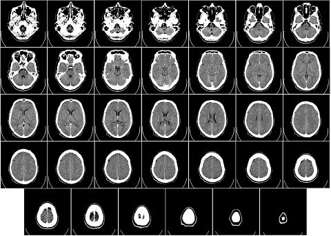 25 Best States For Radiation Therapists